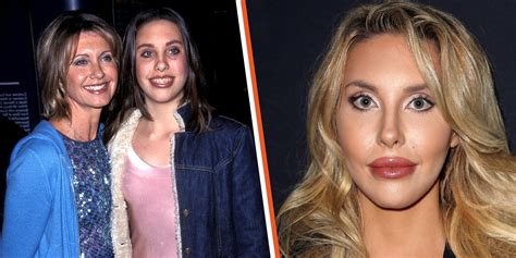 Chloe Lattanzis plastic surgery transformation